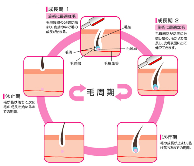 脱毛のお手入れ手順